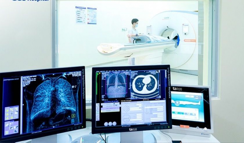 Ung thư phổi sau nhiều năm hút thuốc lá -0