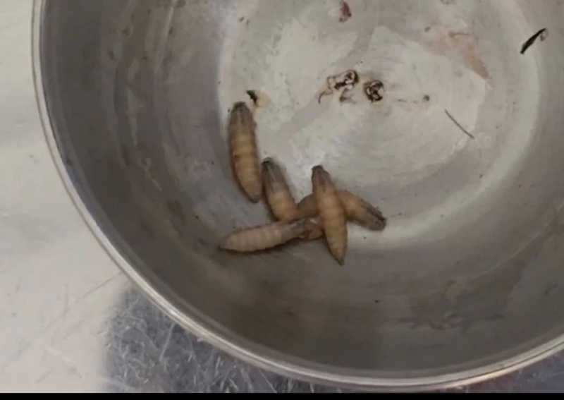             Nội soi “dọn” ổ ấu trùng trong tai một bệnh nhân ở Khánh Hòa -0