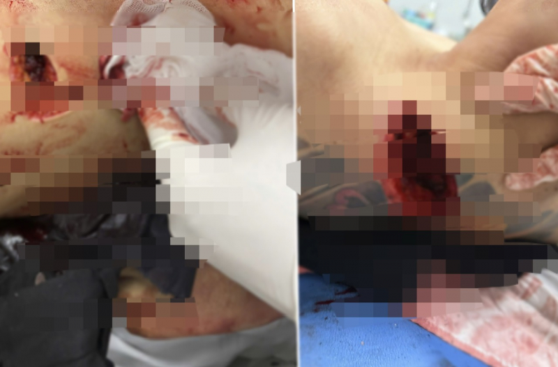 Thanh niên 2 xã mâu thuẫn hỗn chiến, 1 người tử vong -0