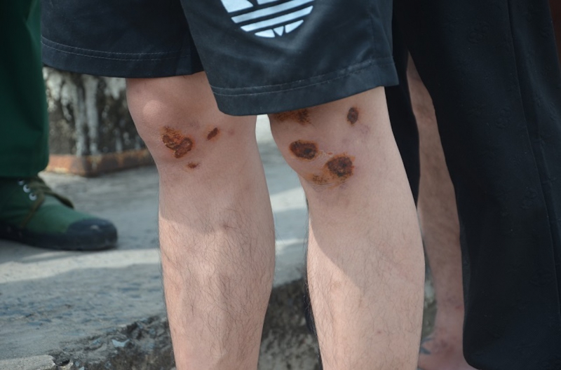 Nước mắt nạn nhân vì tin “việc nhẹ lương cao” rơi vào cạm bẫy nơi xứ người -0