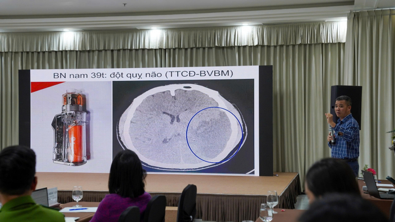 Användning av elektroniska cigaretter och lustgas förkortar unga människors livslängd -0