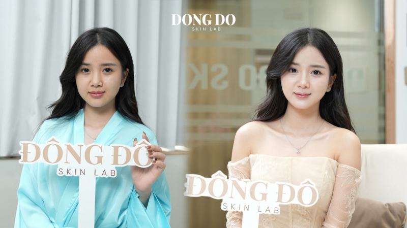 Hivatalosan is megnyílt a Dong Do Kórház csúcstechnológiás bőrgyógyászati és esztétikai központja -0