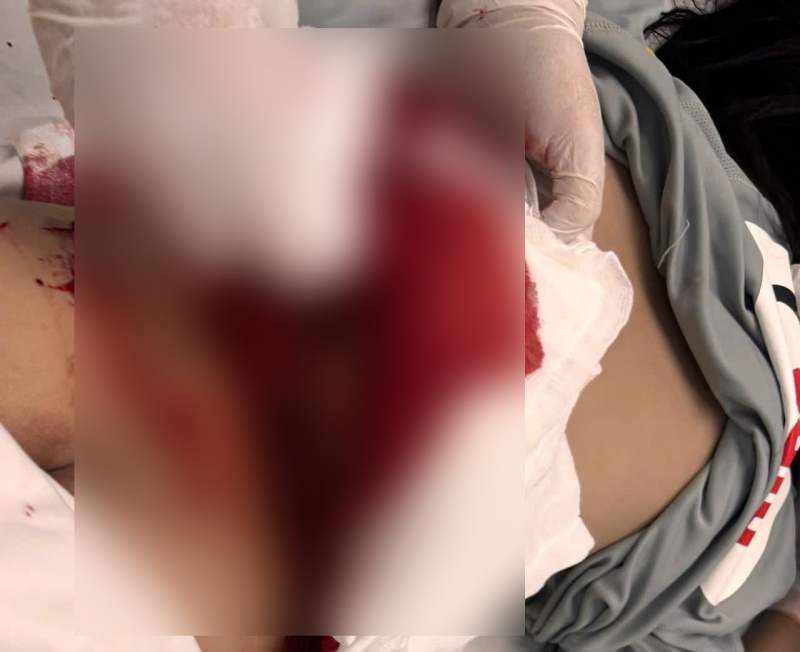 Gutt alvorlig skadet da han sto på ødelagt toalett -0