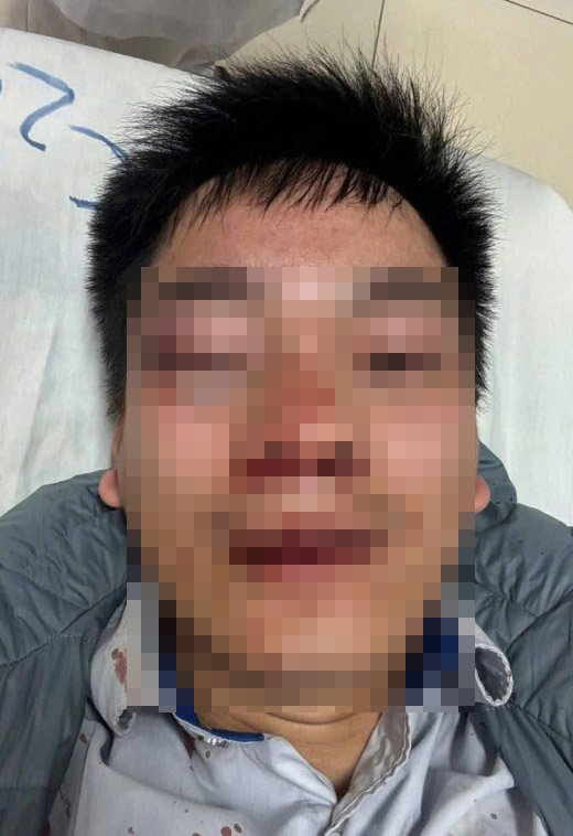 Va chạm nhẹ, người đi đường xông lên đánh lái xe buýt như phim chưởng -0