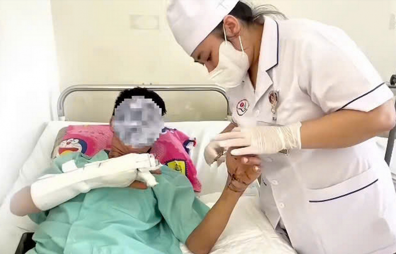 Sau ca vi phẫu 8 giờ xuyên đêm cổ tay bệnh nhân bị đứt lìa được nối lại thành công -0