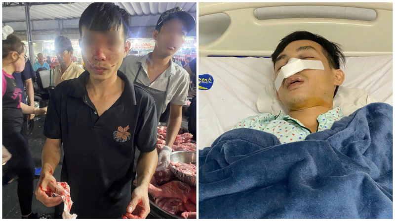 Điều tra vụ nhóm bảo vệ chợ đầu mối Hóc Môn đánh người gãy mũi -0