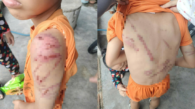 Điều tra vụ bé trai 10 tuổi bị bố bạo hành -0