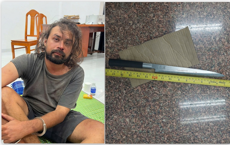 Khẩn trương xử lý vụ cán bộ Công an bị người nước ngoài đâm trọng thương -0