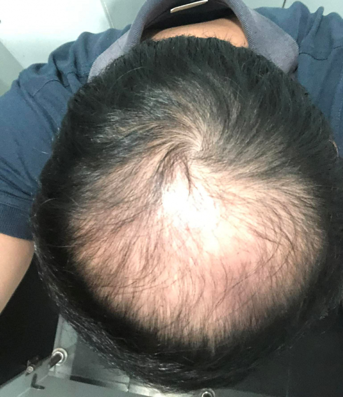 Lộ diện thủ đoạn lừa đảo người bệnh tại các cơ sở thẩm mỹ “chui”  -0