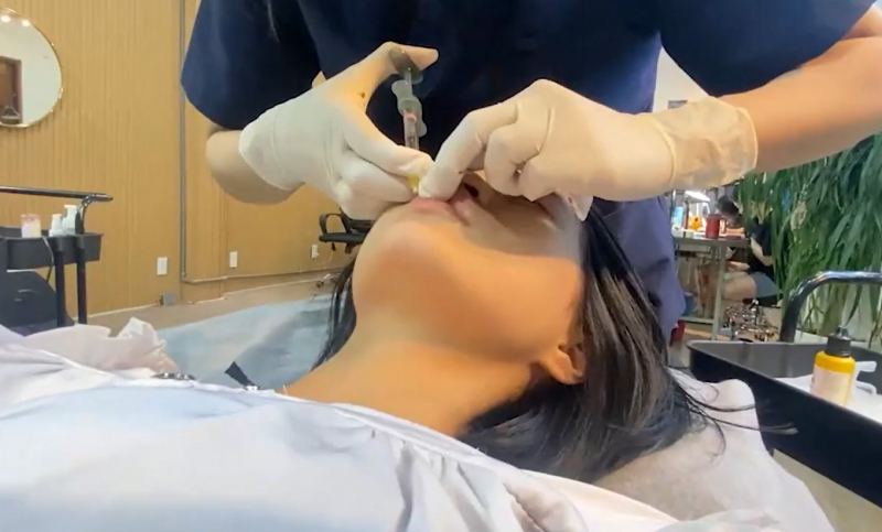 Xử lý nghiêm một cơ sở “thẩm mỹ chui” tiêm filler gây biến chứng  -0