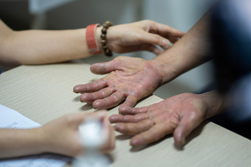 Bác sĩ khuyến cáo cách phòng bệnh da liễu bùng phát vào đầu hè -0