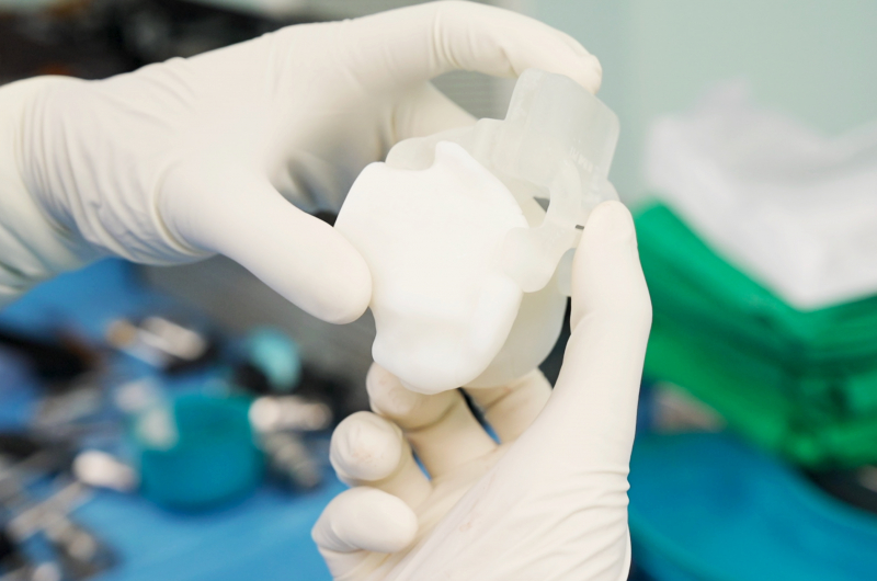 Bước ngoặt trong phẫu thuật thay khớp tại Việt Nam -0