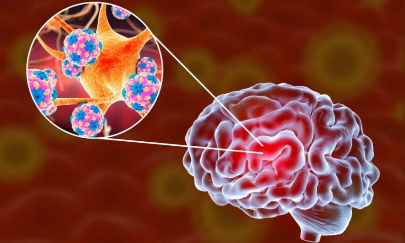 Bộ Y tế khuyến cáo bệnh viêm não mô cầu sau 4 ca tử vong -0