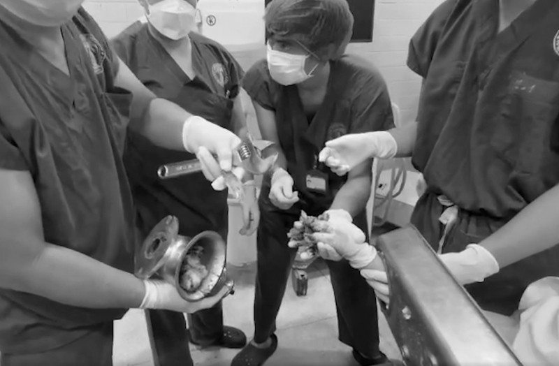 Nữ tiểu thương bị máy xay thịt cuốn nát bàn tay -1