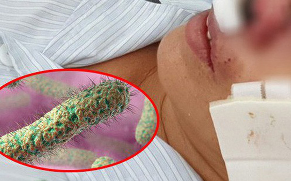 Bộ Y tế khuyến cáo về bệnh sau 23 ca tử vong ở Thái Lan -0