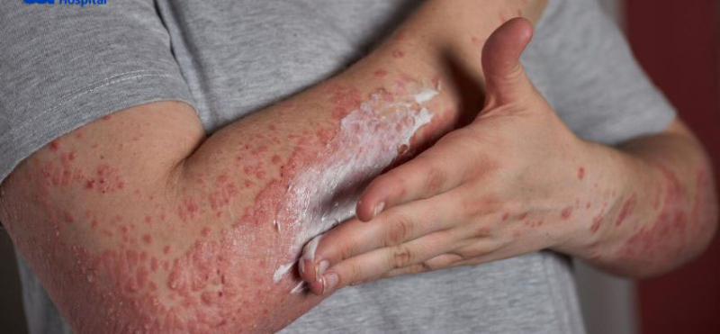 Mua thuốc gia truyền 