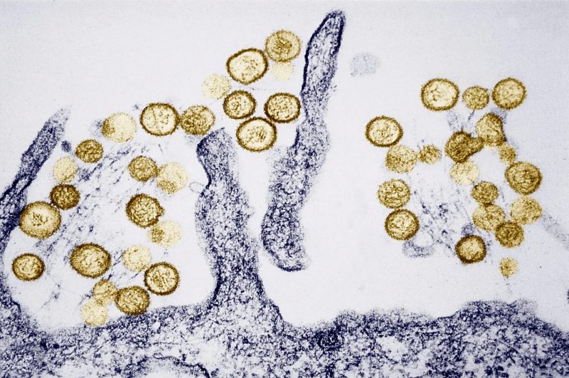 Ổ dịch virus Hanta trên tàu du lịch Đại Tây Dương tăng lên 8 ca, WHO đang truy vết -0