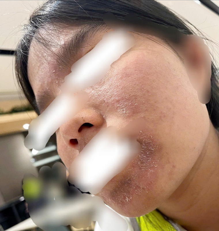 h4.jpg -3